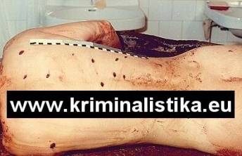 Stichwunden auf dem Opferkörper