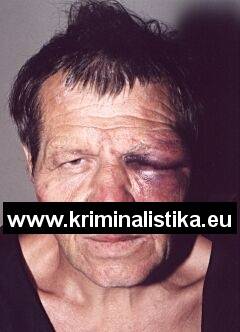 The murderer short after being arrested