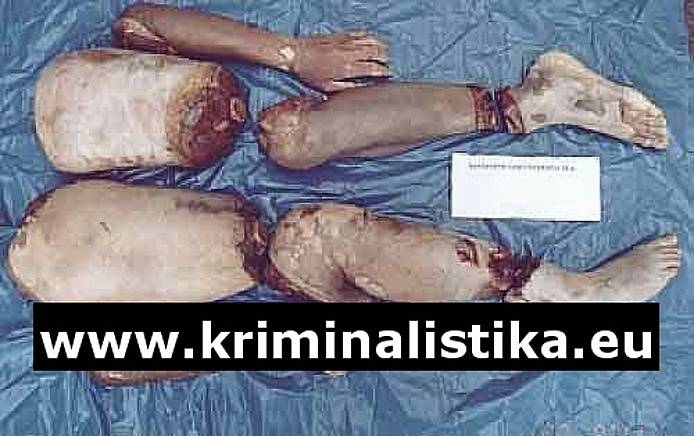 Složené části končetin řezané pilkou na železo