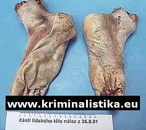 Složené části končetin