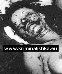 Parkerová na pitevně